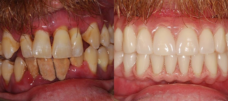 Elite Prosthetic Dentistry: Dr. Gerald M. Marlin