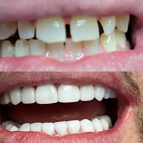 AF1QipO-PVRrUjToWcEhL7pvh9cbJNsd3ITGL-QUknQLw800-h500-k-no.jpg